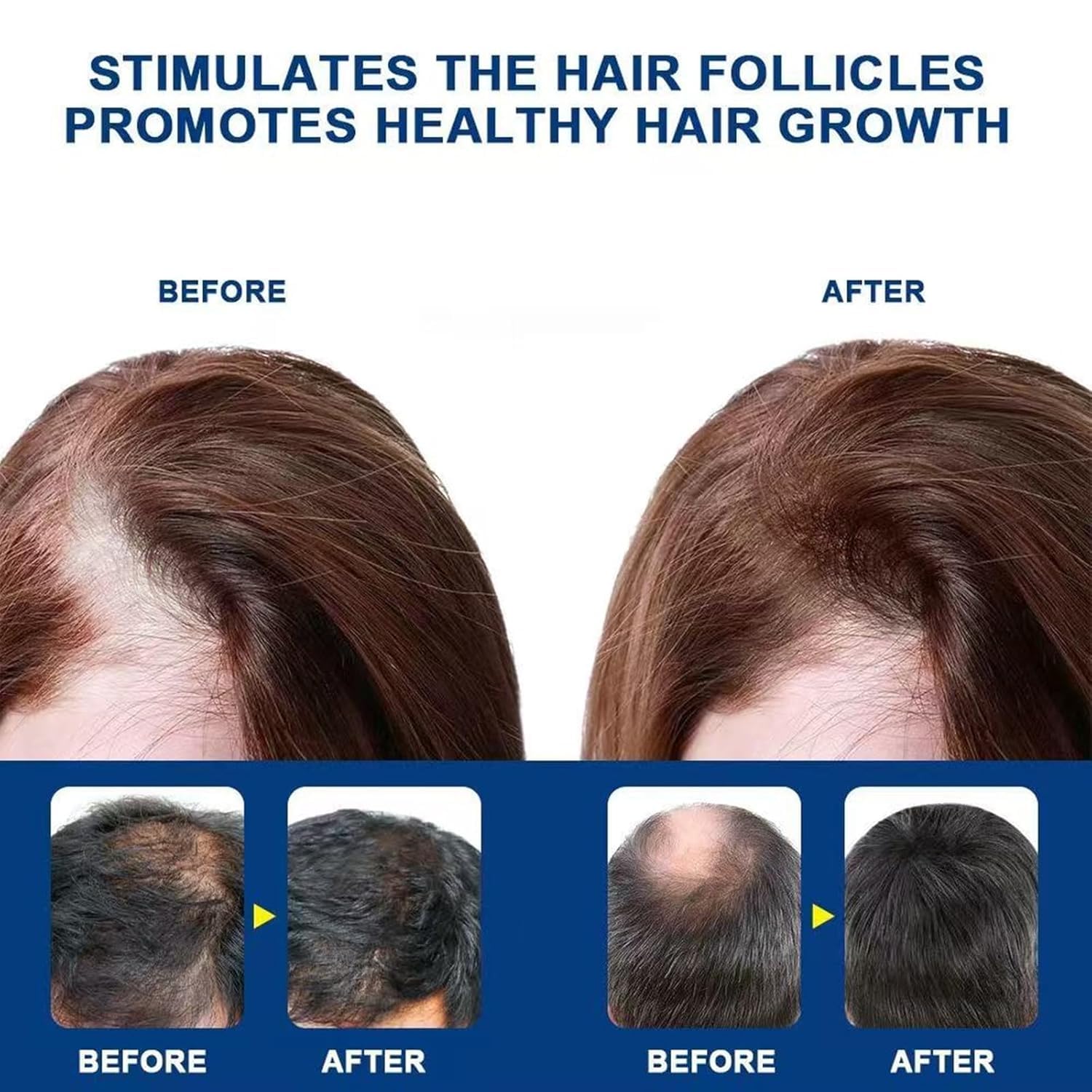 ATHNO ingredient label close-up listing minoxidil, biotin and rosemary for ingredient clarity