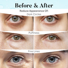 AURAE patch applied under eye illustrating quick soothing effect