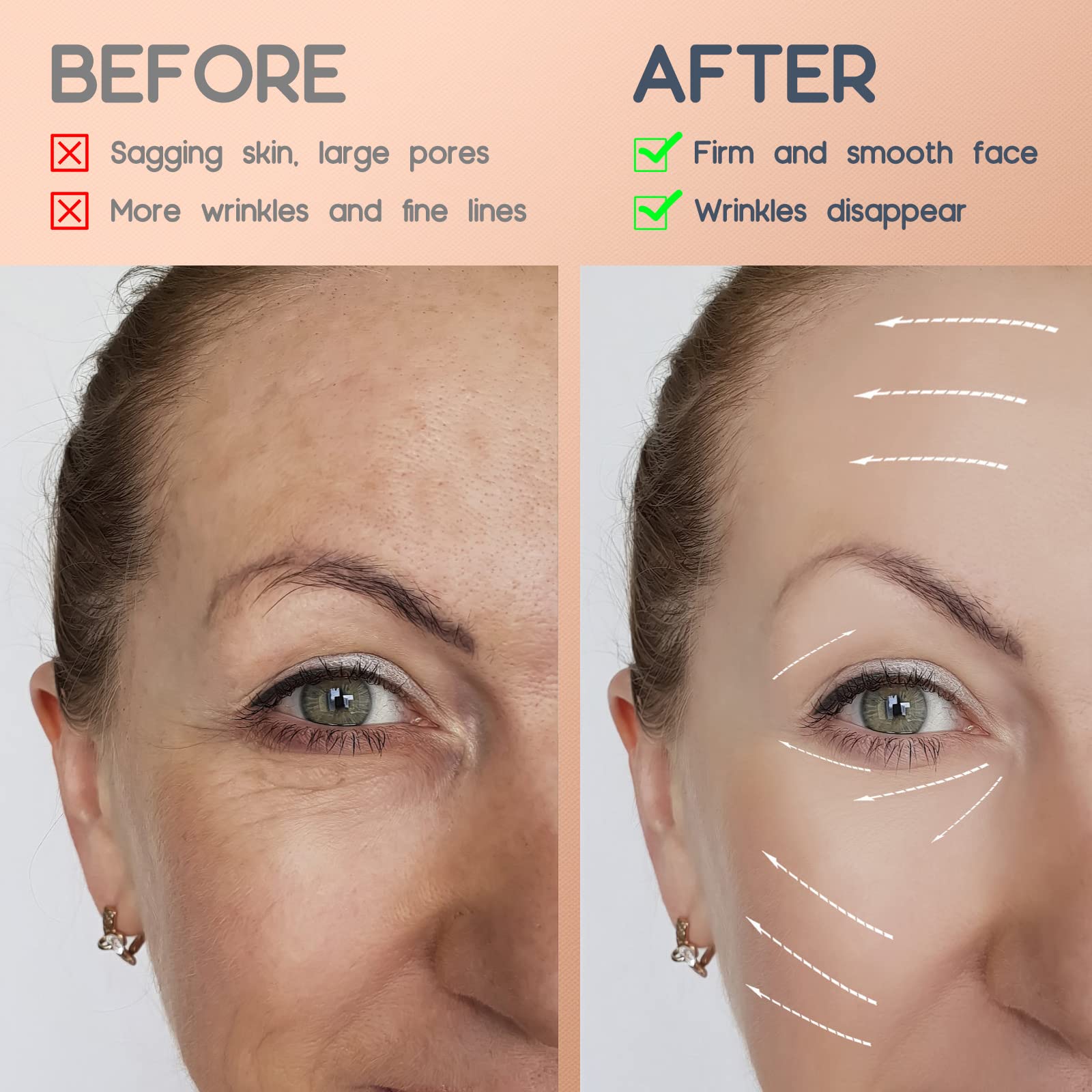 AURUZA tape on neck highlighting firmer-looking contours and targeted lift