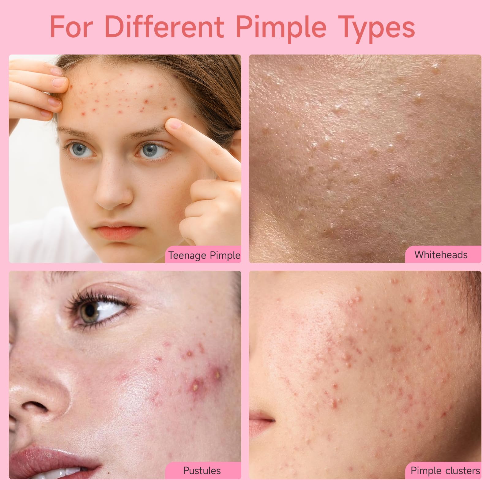 AUSLKA patch applied on cheek offering discreet blemish coverage