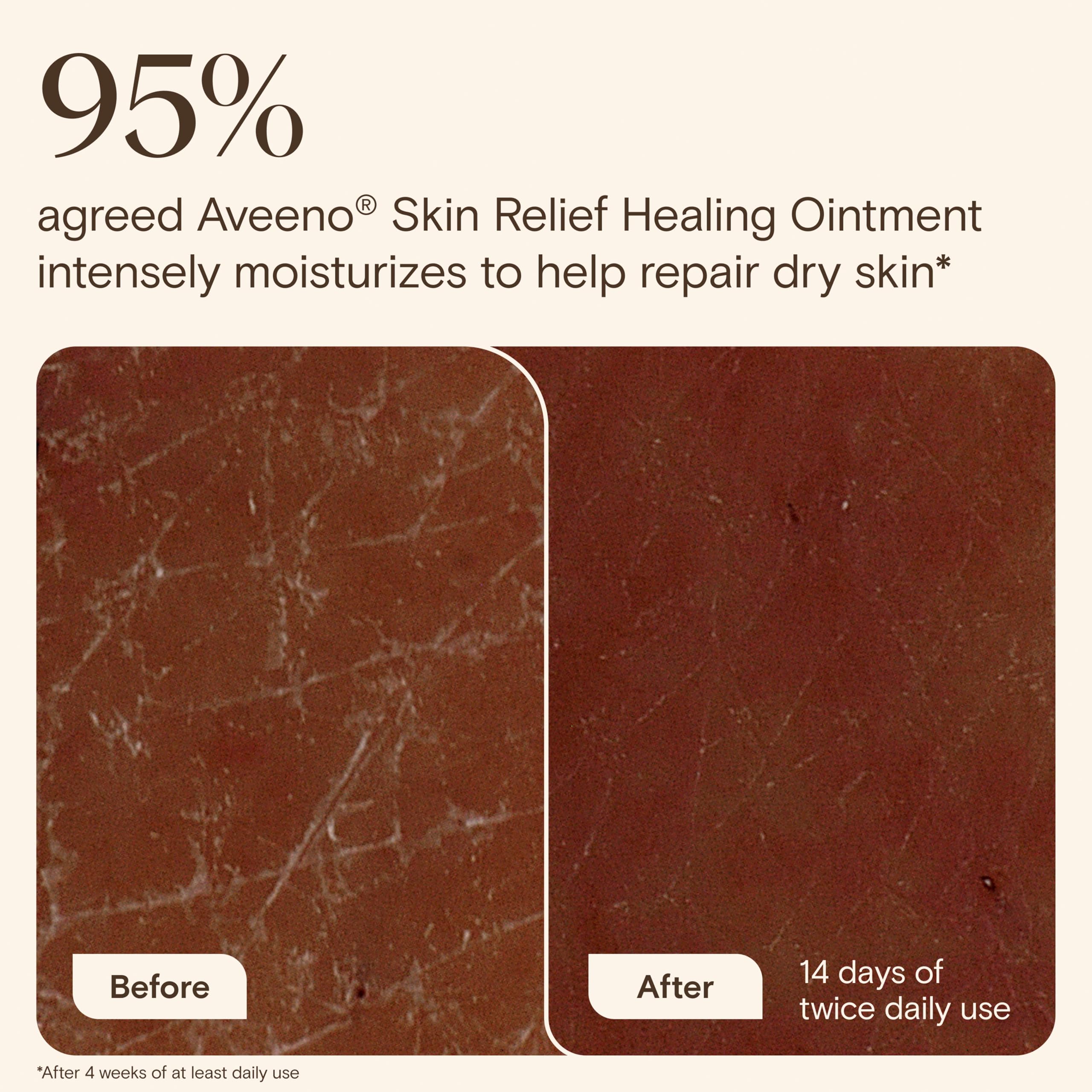 Aveeno ointment applied to lips to relieve chapping and cracking