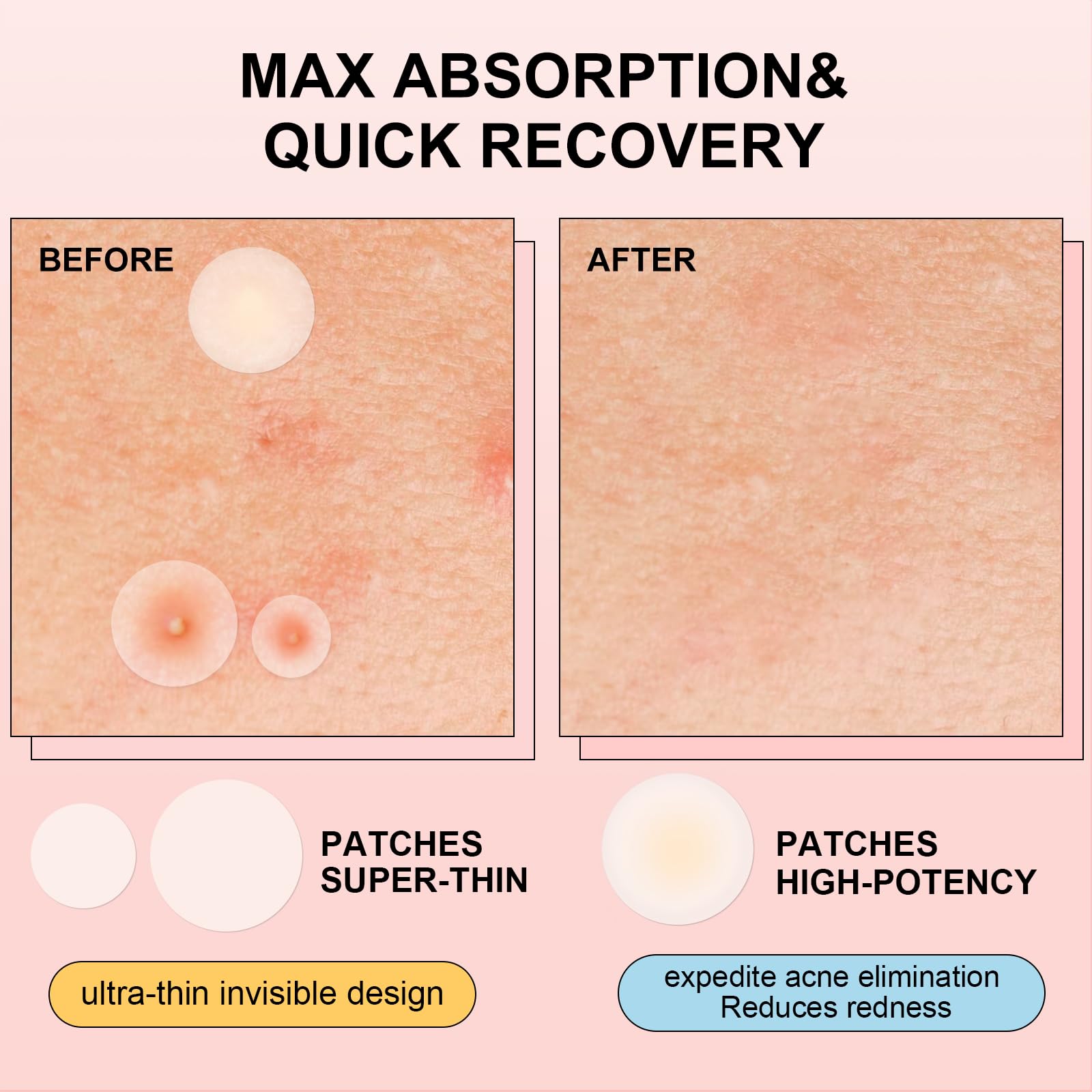 AVJONE daytime patch close-up revealing ultra-thin invisible coverage benefit