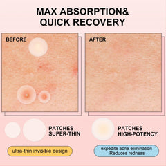 AVJONE daytime patch close-up revealing ultra-thin invisible coverage benefit