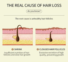 Axnzp before and after comparison illustrating improved hair strength