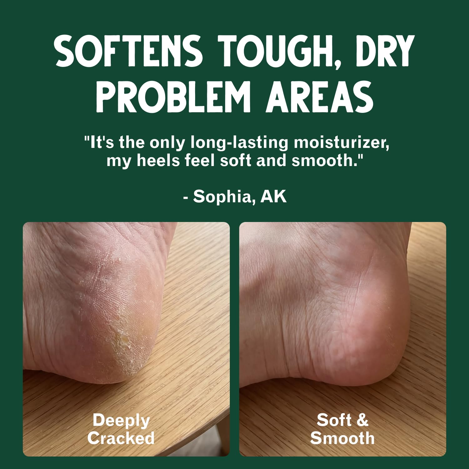 Bag Balm in an outdoor first-aid kit demonstrating versatile skin care