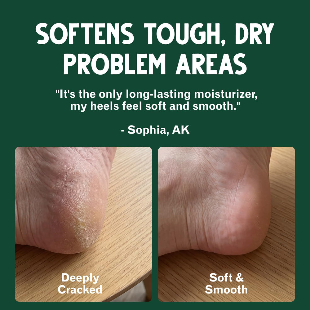 Bag Balm in an outdoor first-aid kit demonstrating versatile skin care