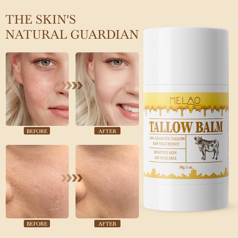 BAISEN DIARY being smoothed on elbow to soothe rough patches effectively