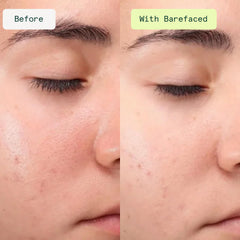 Barefaced Clean Slate droplet on skin highlighting hydration and soothing