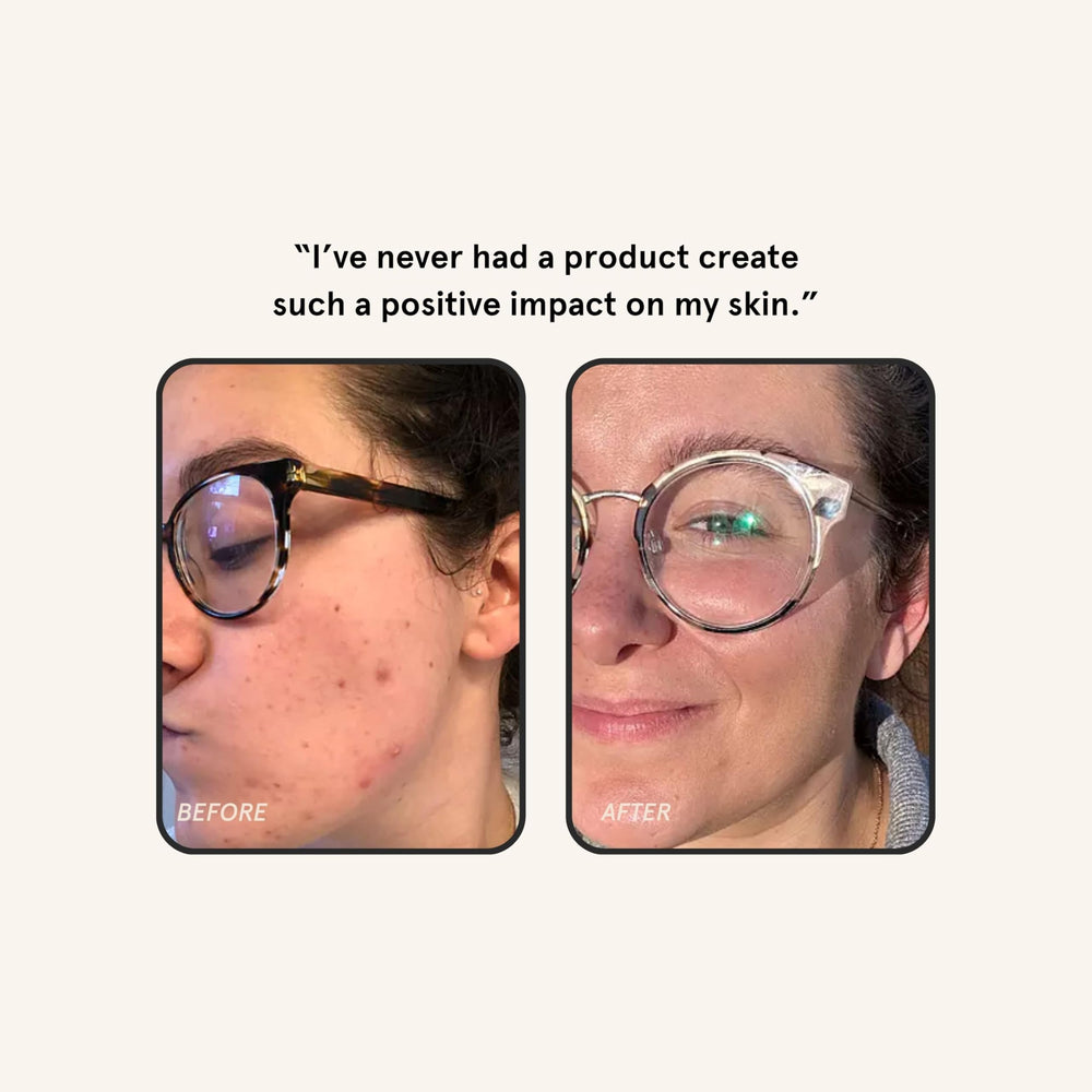 Barefaced applied to jawline close-up demonstrating smoothing and targeted treatment