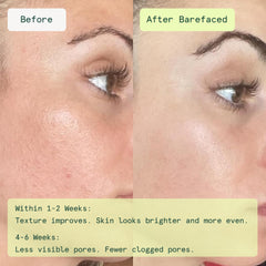 Barefaced close-up of a pad texture highlighting exfoliating surface