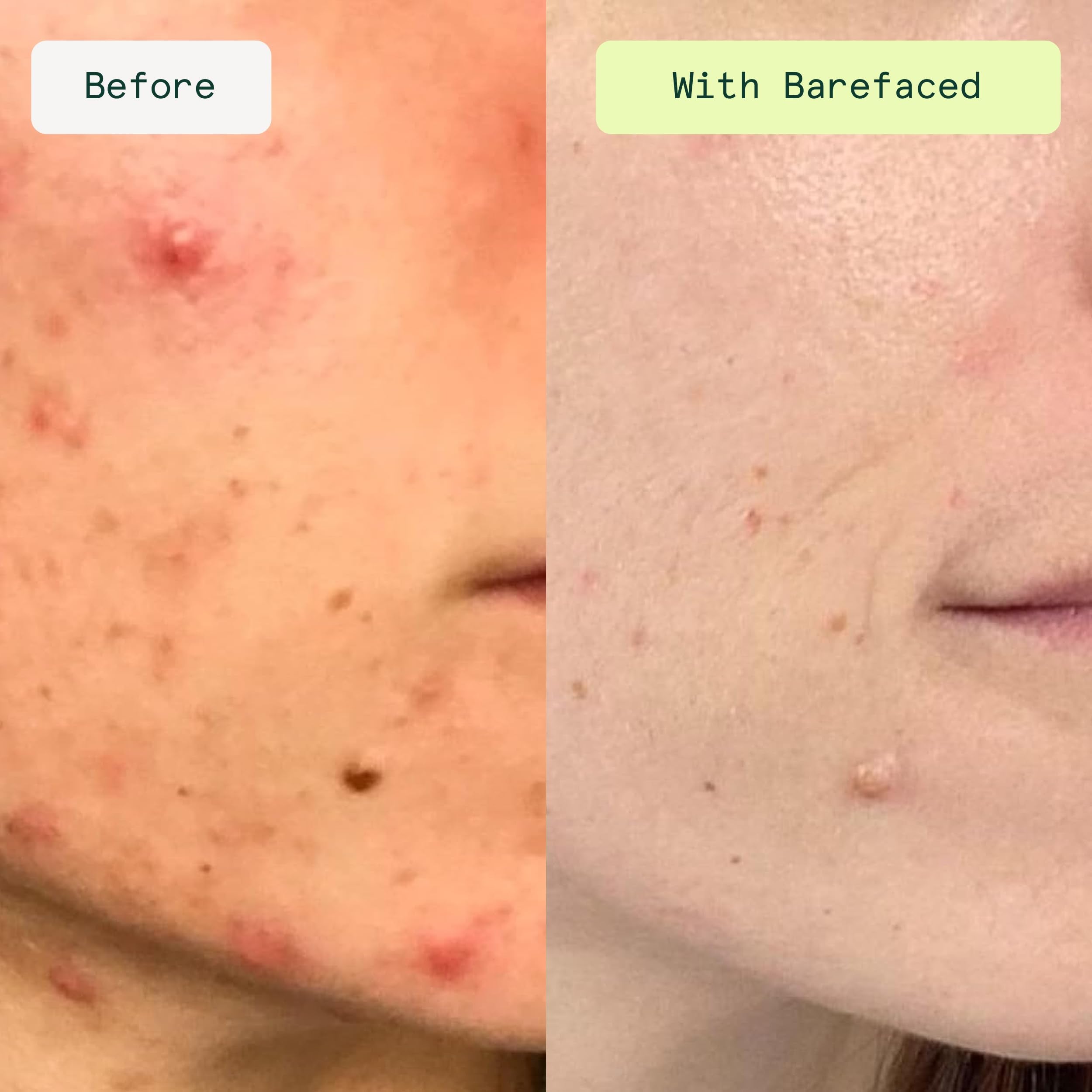 Barefaced open jar with stacked pads ready to use for fast exfoliation