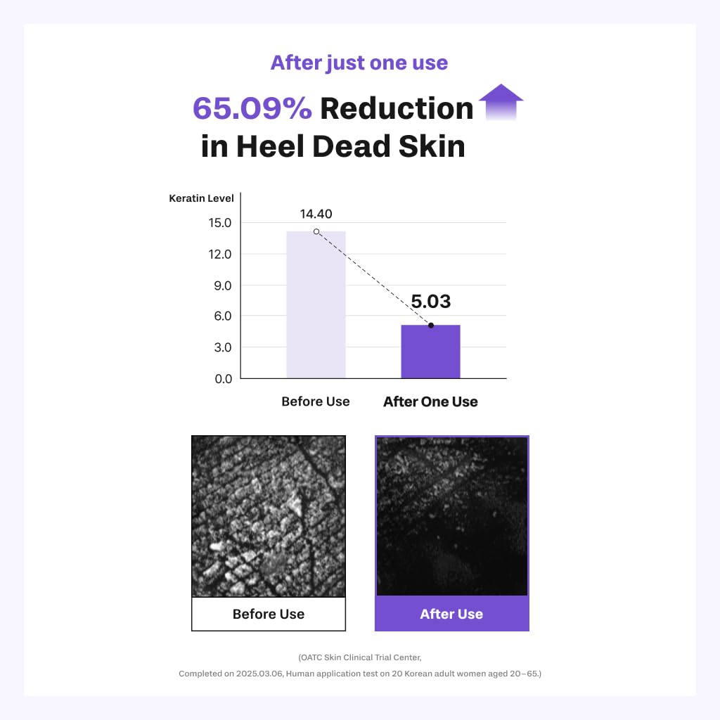 Baren patch on elbow demonstrating versatility and skin softening