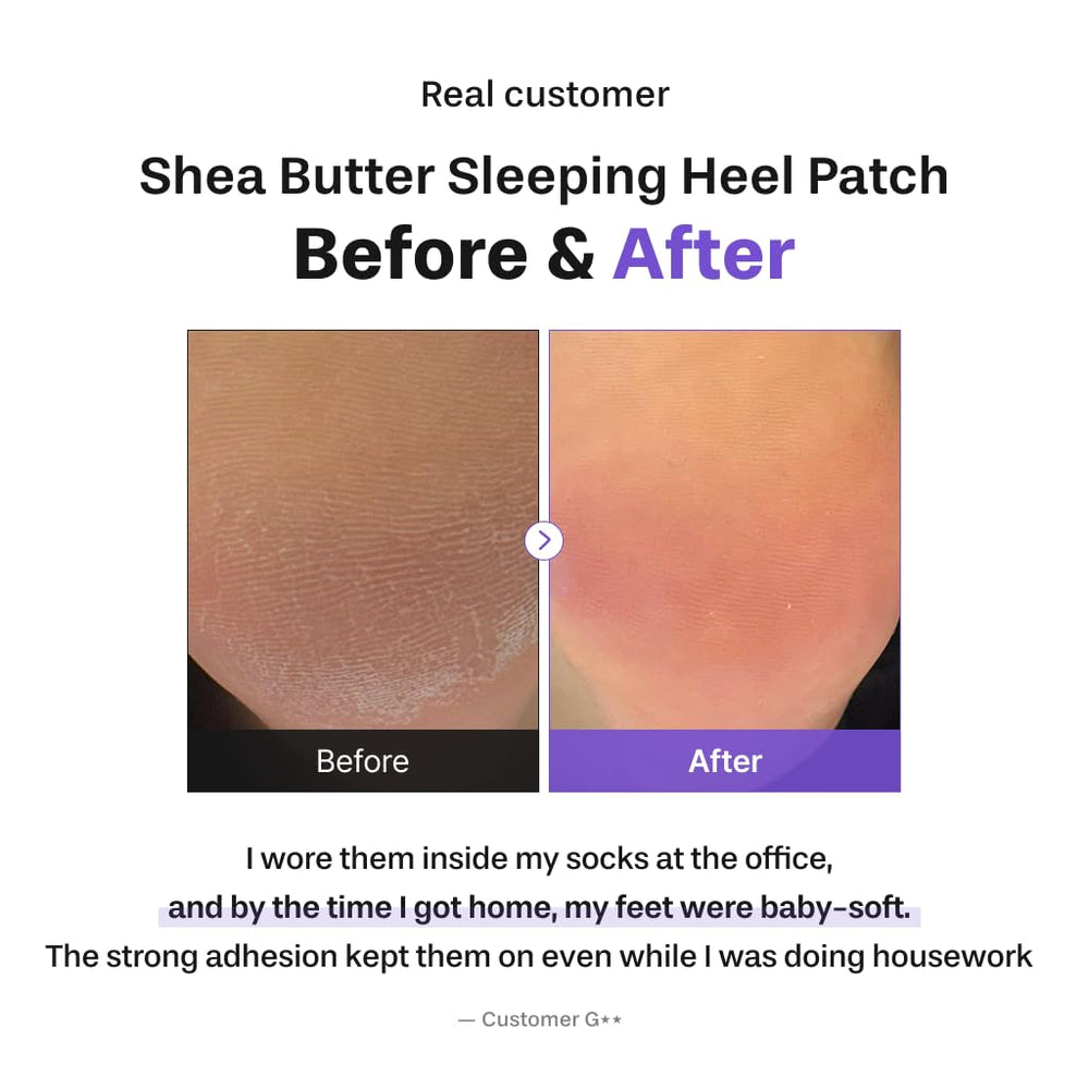 Baren patch applied to heel demonstrating secure overnight fit