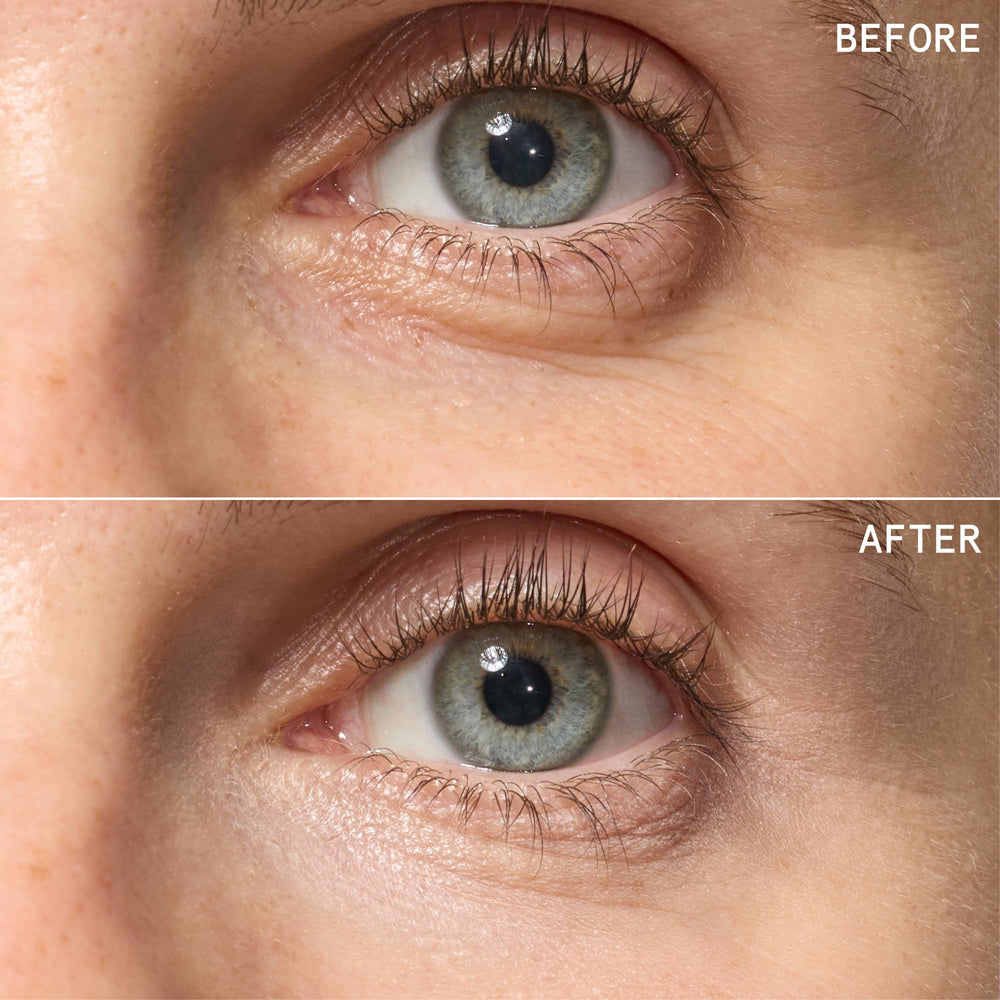 Beauty Pie side-by-side before and after showing reduced under-eye darkness appearance
