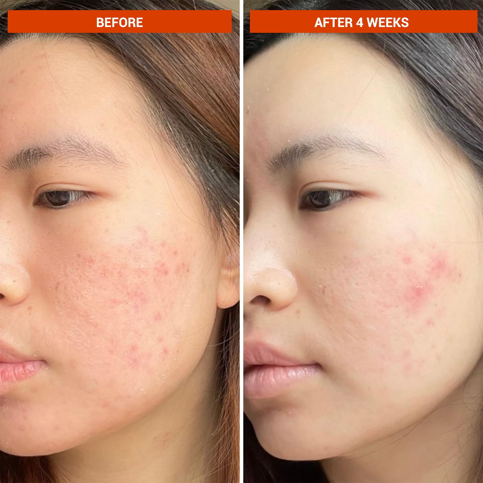 BeautyStat cap and nozzle detail for precise, mess-free dispensing benefit