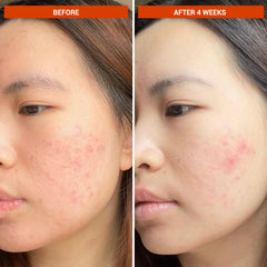 BeautyStat cap and nozzle detail for precise, mess-free dispensing benefit