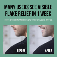 Berk's before and after scalp photo showing reduced flakes and relief