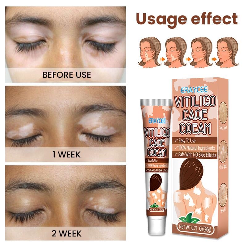 BERVEAL before and after comparison highlighting reduced white spots and improved tone