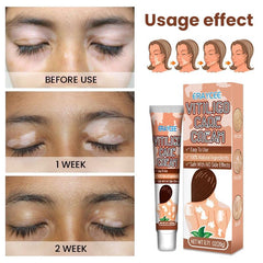BERVEAL before and after comparison highlighting reduced white spots and improved tone