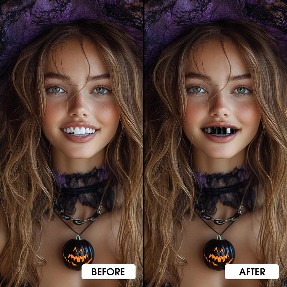BEUSELF before and after smile comparison showing dramatic transformation