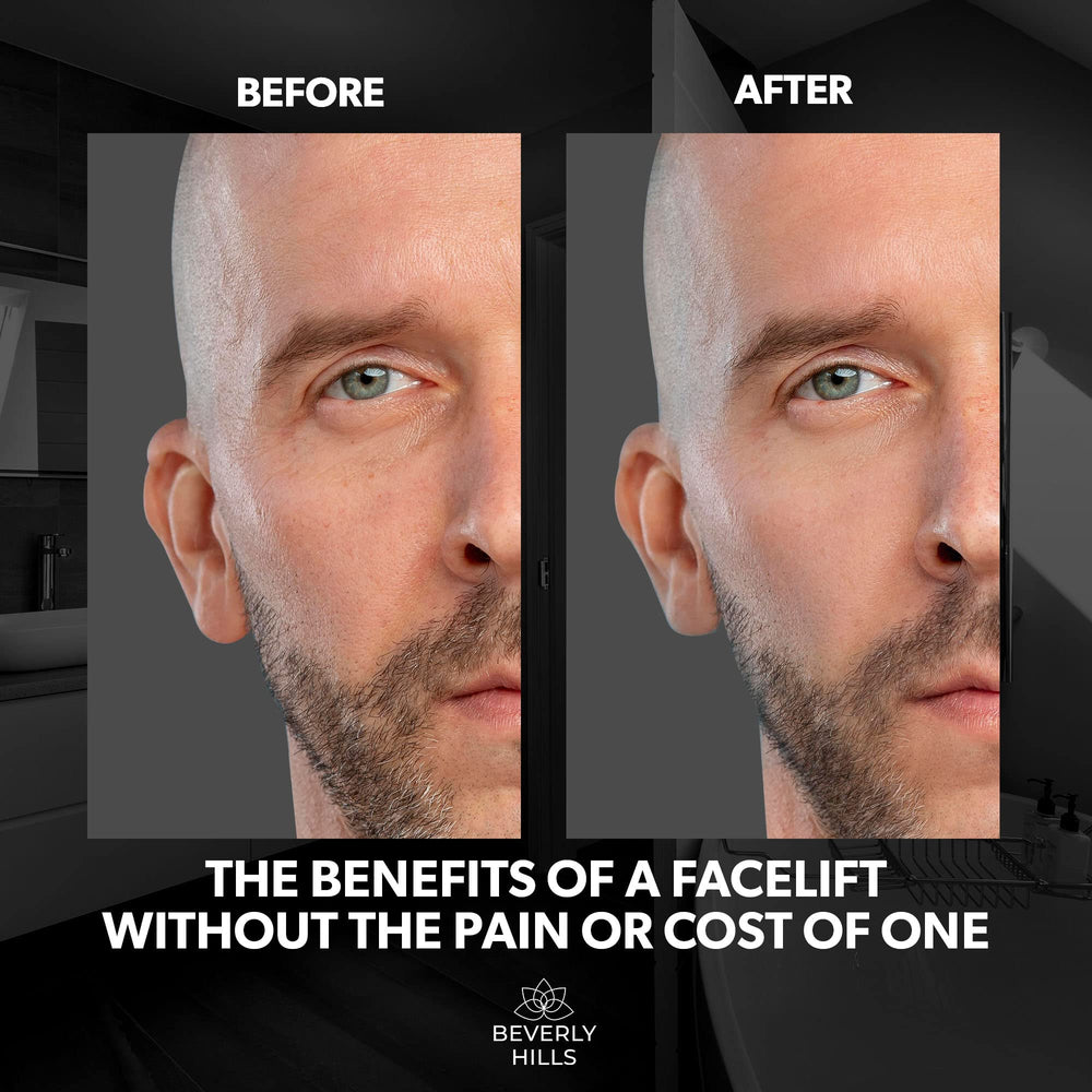 Beverly Hills applied under-eye area showing reduced puffiness and refreshed appearance