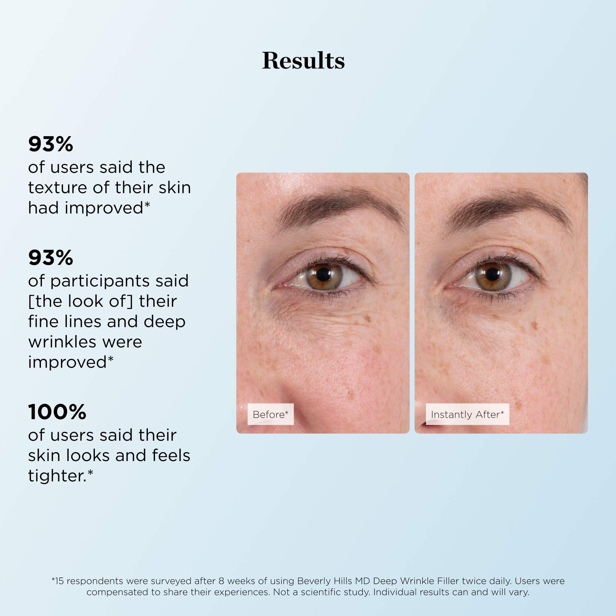 Beverly Hills MD before and after crease reduction demonstration benefit
