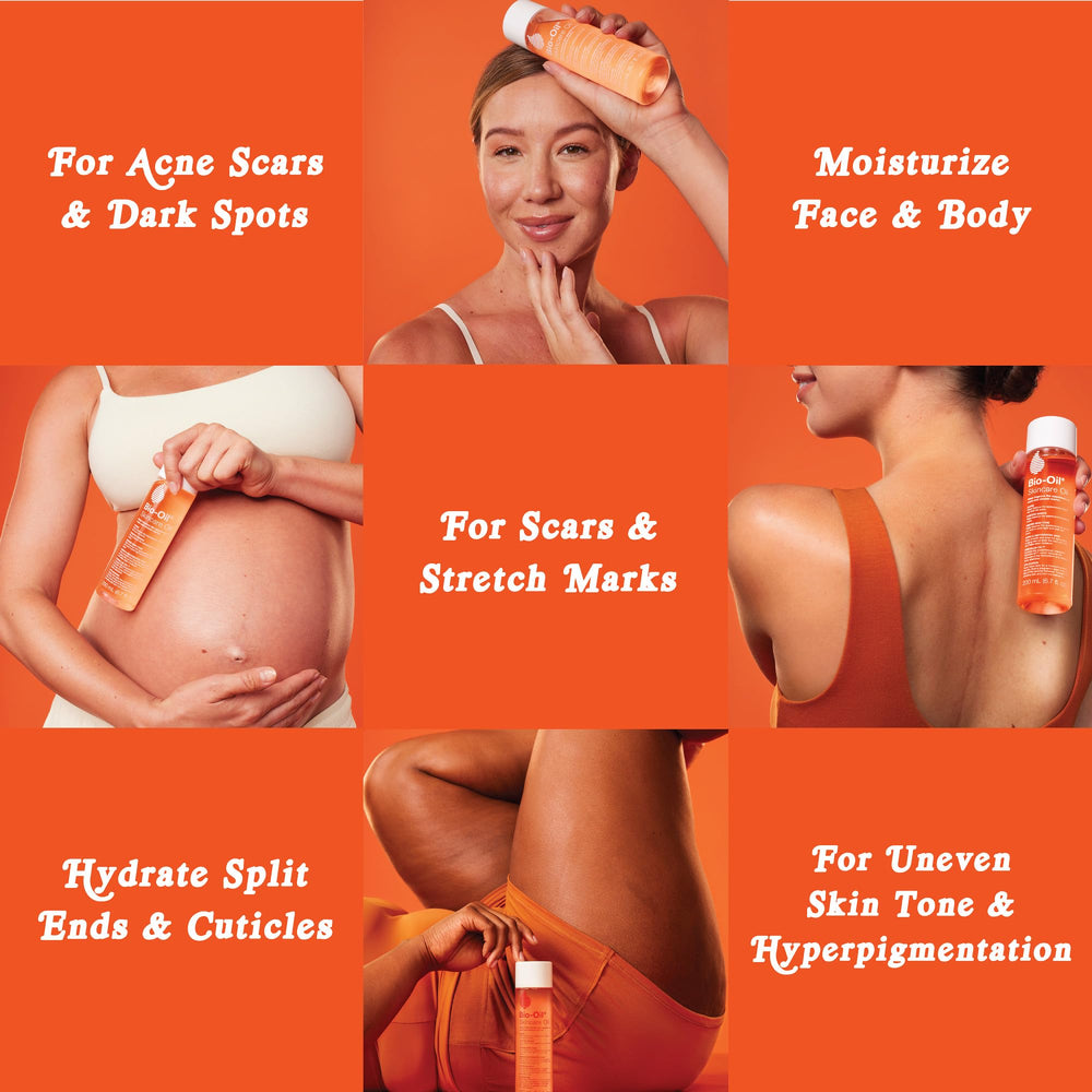 Bio-Oil being applied to arms demonstrating stretch mark care benefit