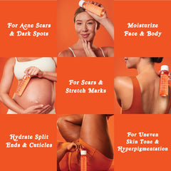 Bio-Oil being applied to arms demonstrating stretch mark care benefit