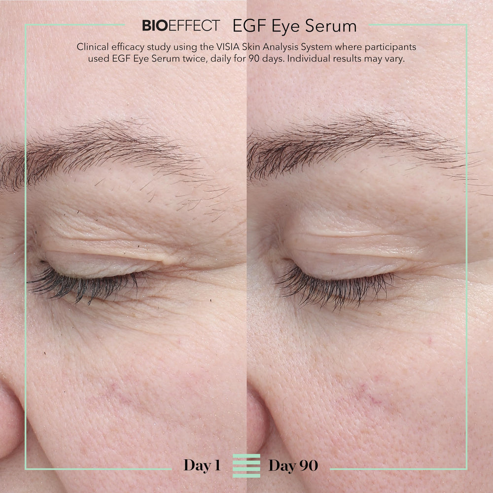 BIOEFFECT gel texture dotted on skin demonstrating lightweight hydration instantly