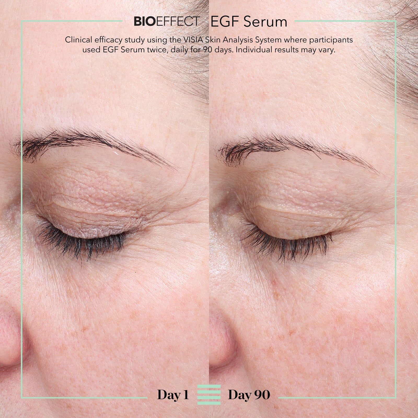 Bioeffect EGF Serum ingredient chart highlighting barley EGF and hyaluronic acid benefits