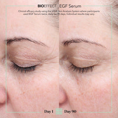 Bioeffect EGF Serum ingredient chart highlighting barley EGF and hyaluronic acid benefits