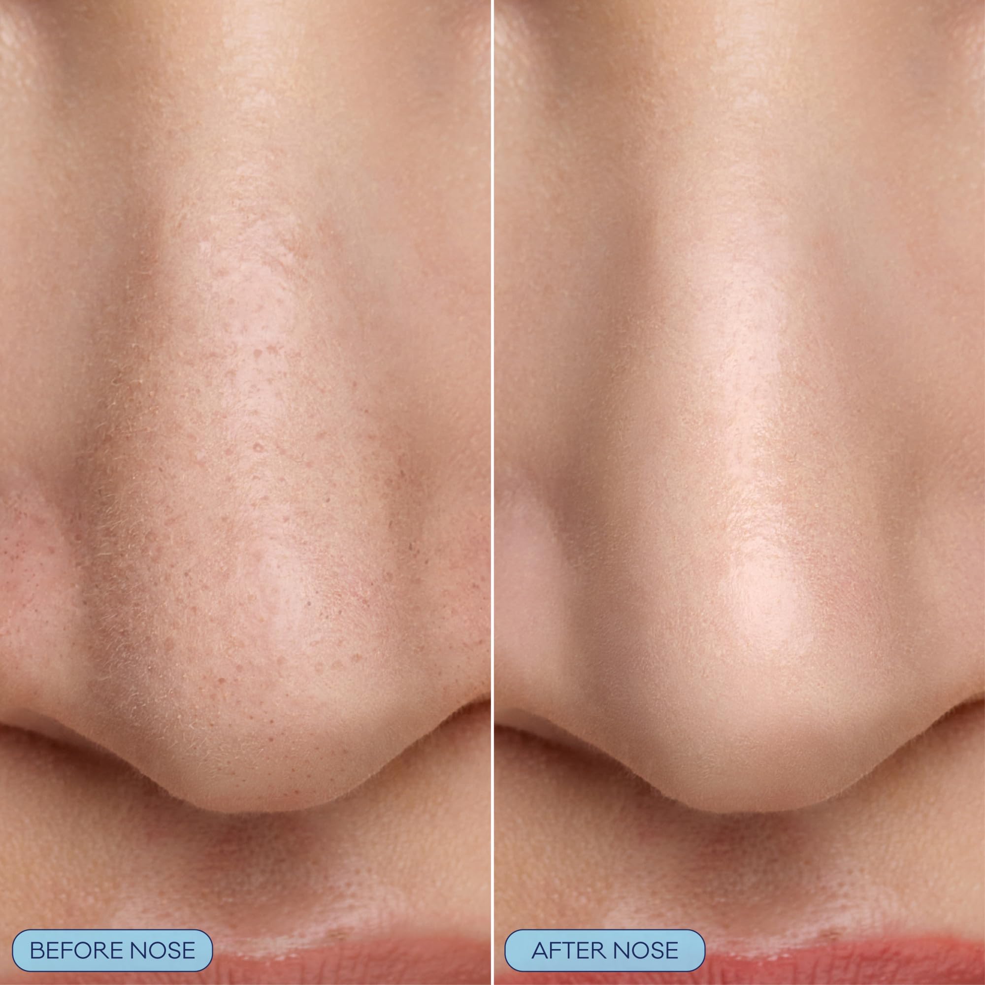 Bioré bubbling nose mask on skin demonstrating deep pore cleaning