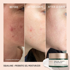 BIOSSANCE dispensing gel onto fingertip to demonstrate easy application and fast absorption