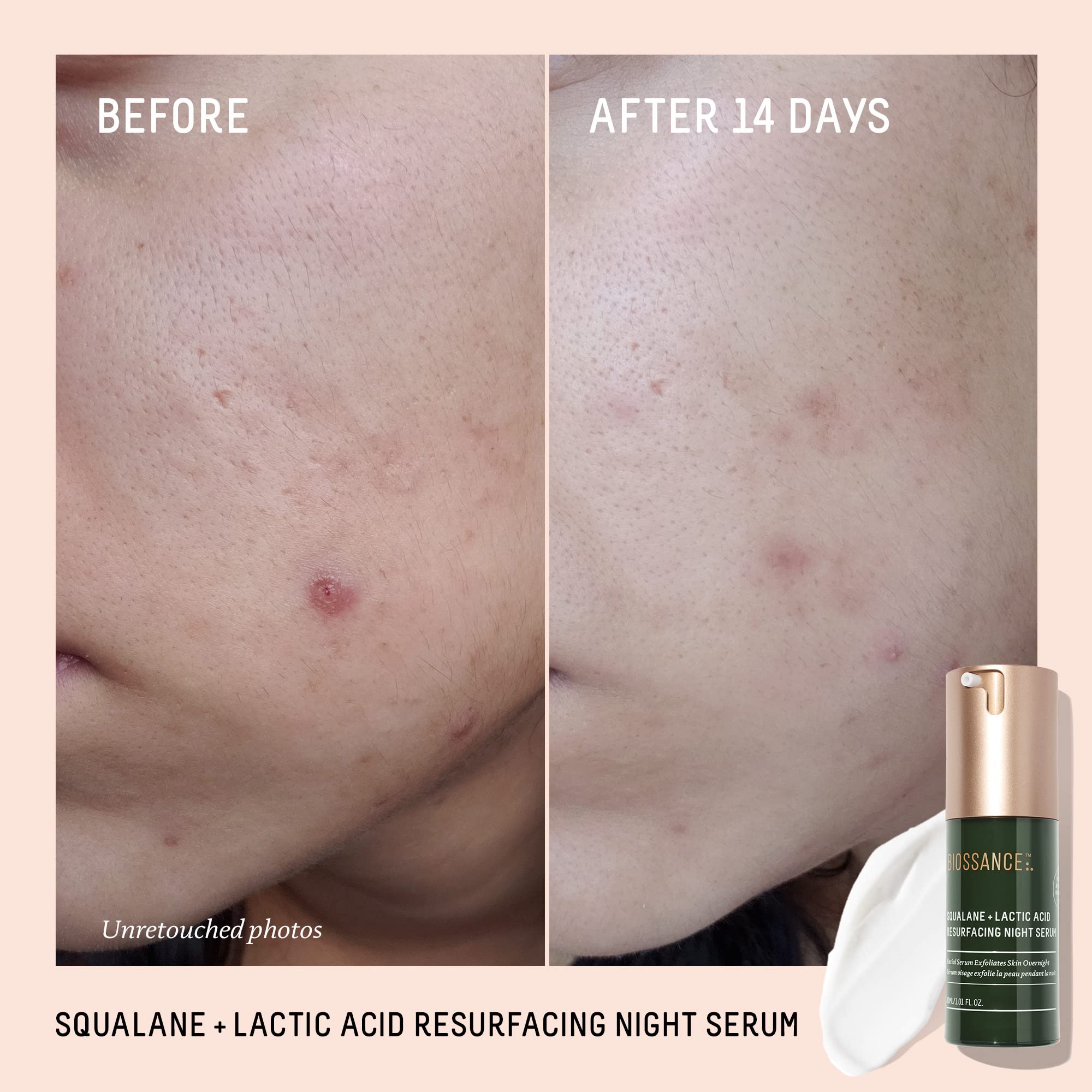 BIOSSANCE dropper dispensing serum demonstrating controlled application benefit