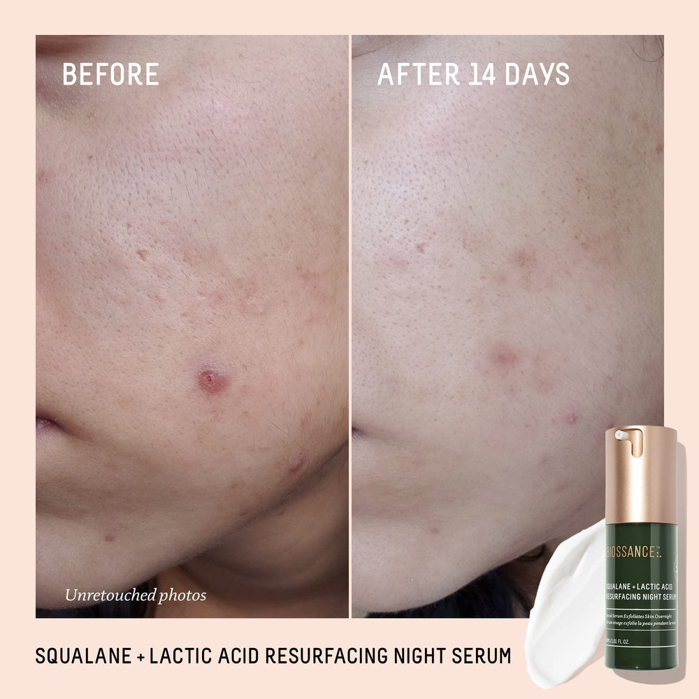 BIOSSANCE dropper dispensing serum demonstrating controlled application benefit