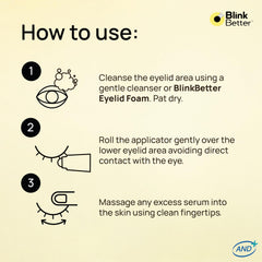 BlinkBetter roller beside travel items illustrating convenient on-the-go relief