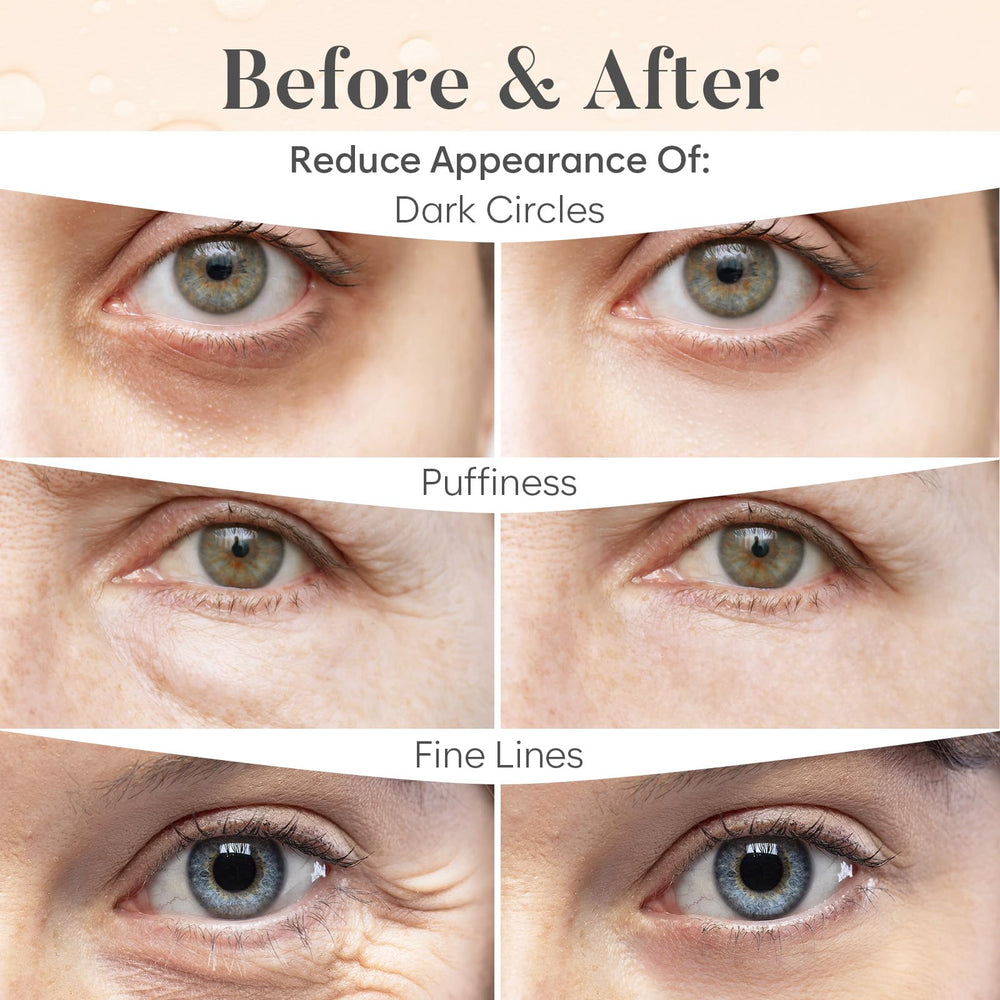 BLOOMORA patch applied under eye demonstrating reduced puffiness effect