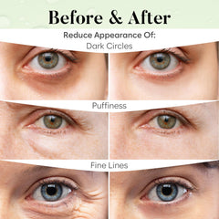 BLOOMORA application on under-eye to show proper placement and cooling effect