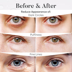 BLOOMORA under-eye application on model, demonstrates cooling de-puffing effect