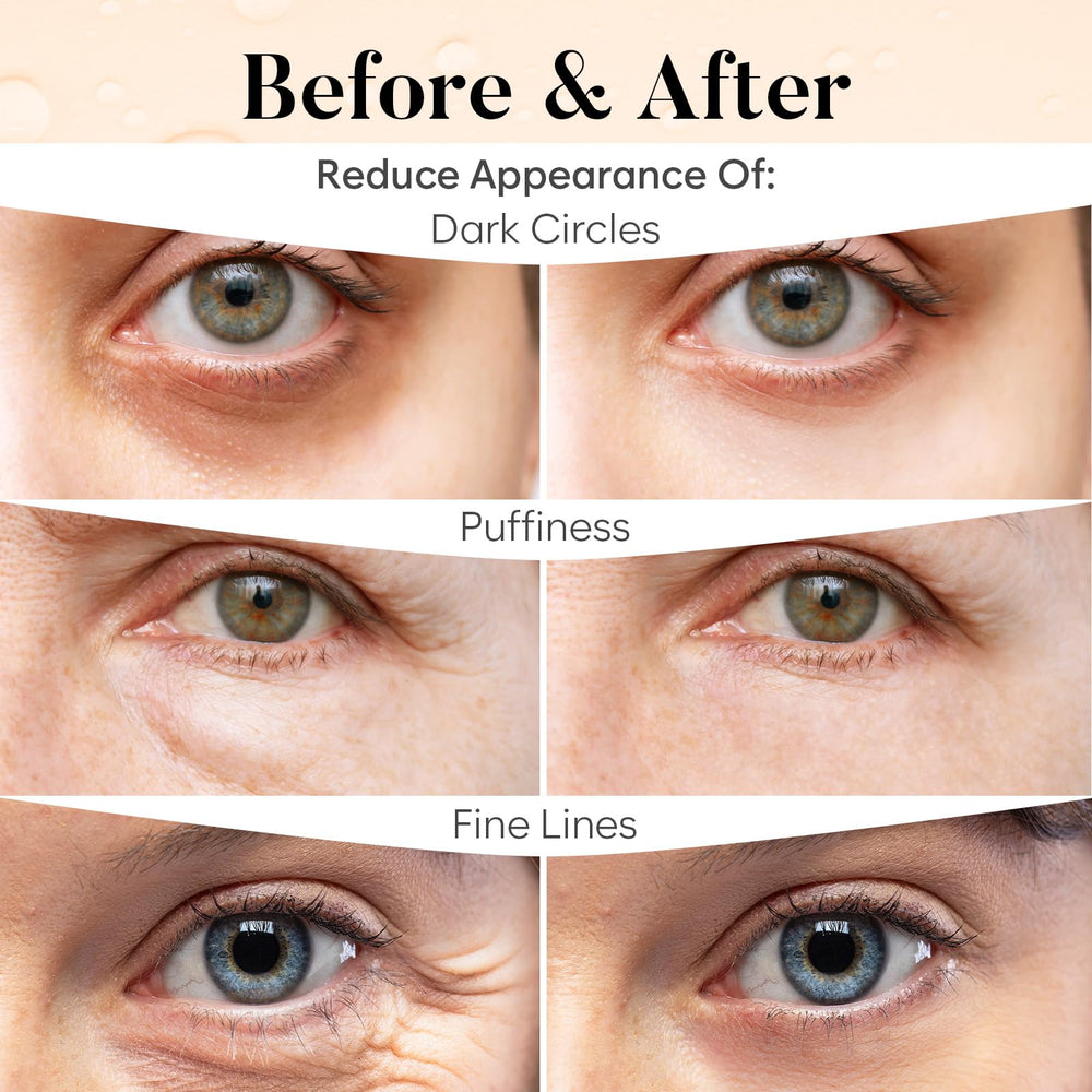 BLOOMORA before and after under-eye comparison showing visible refresh