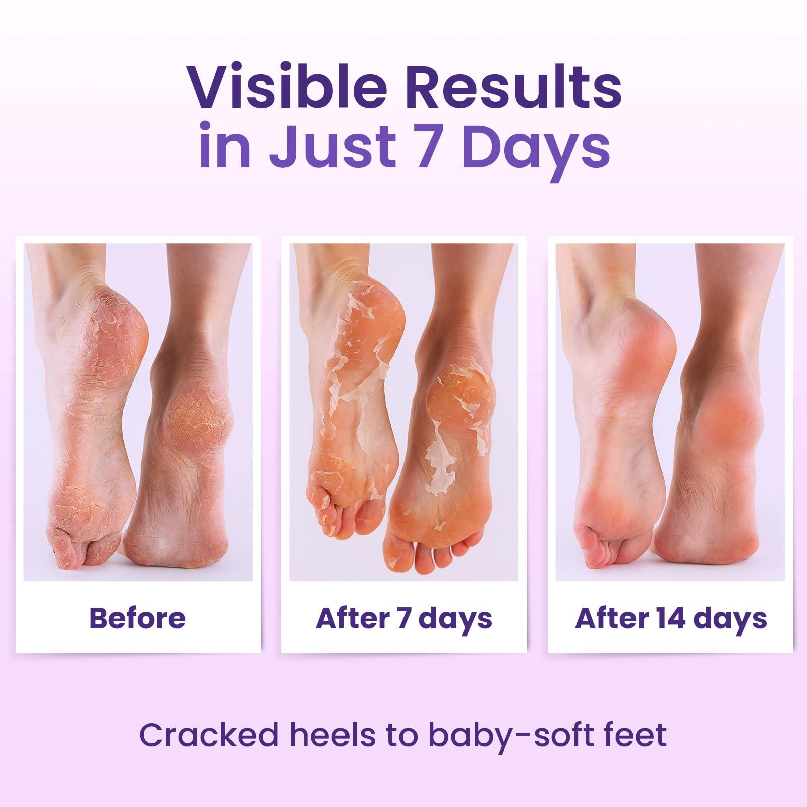 BLOOMORA in use with a person relaxing while the peel works for effortless care