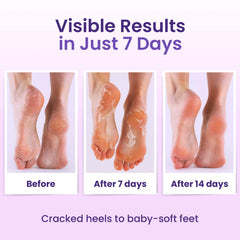BLOOMORA in use with a person relaxing while the peel works for effortless care