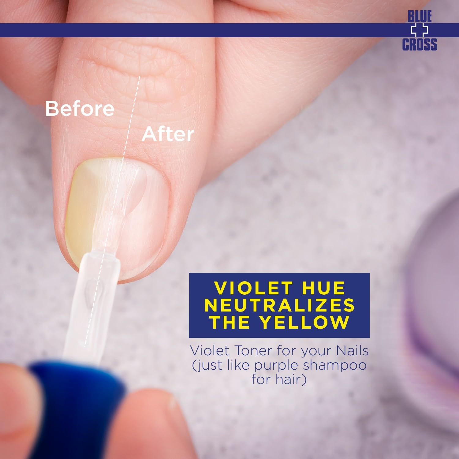 Blue Cross before and after nails showing yellow neutralization and brighter nail appearance