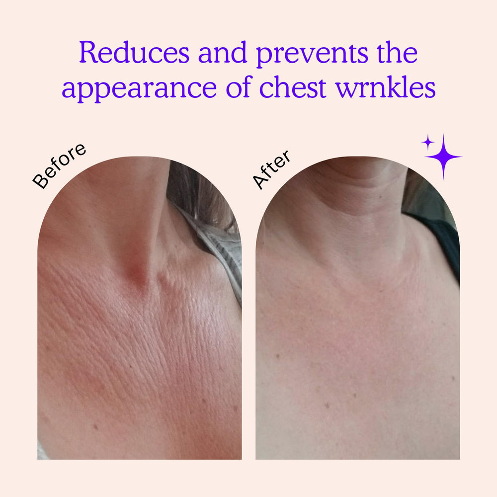 BLUMBODY close-up of silicone texture illustrating gentle contouring benefit