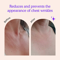 BLUMBODY close-up of silicone texture illustrating gentle contouring benefit