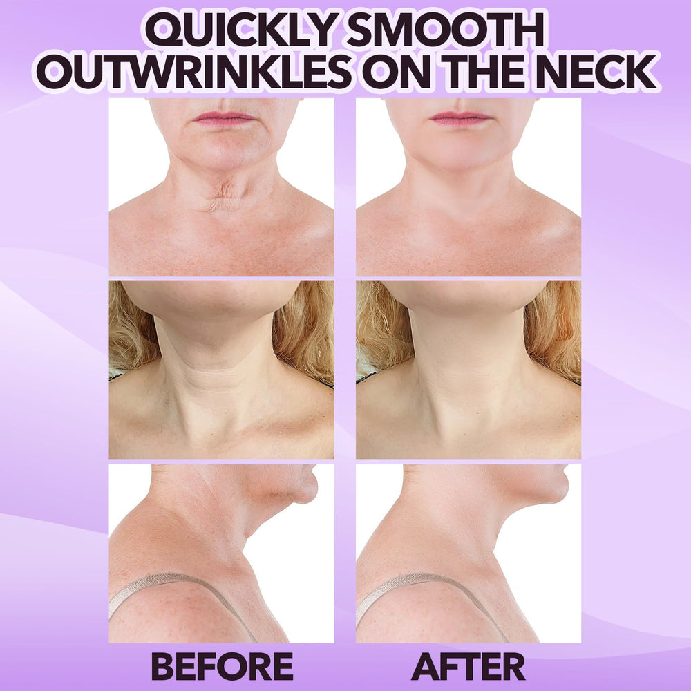 bocello before and after jawline comparison highlighting visible contouring