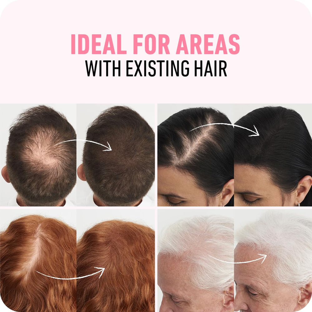 Boldify before and after crown view highlighting fuller hair result