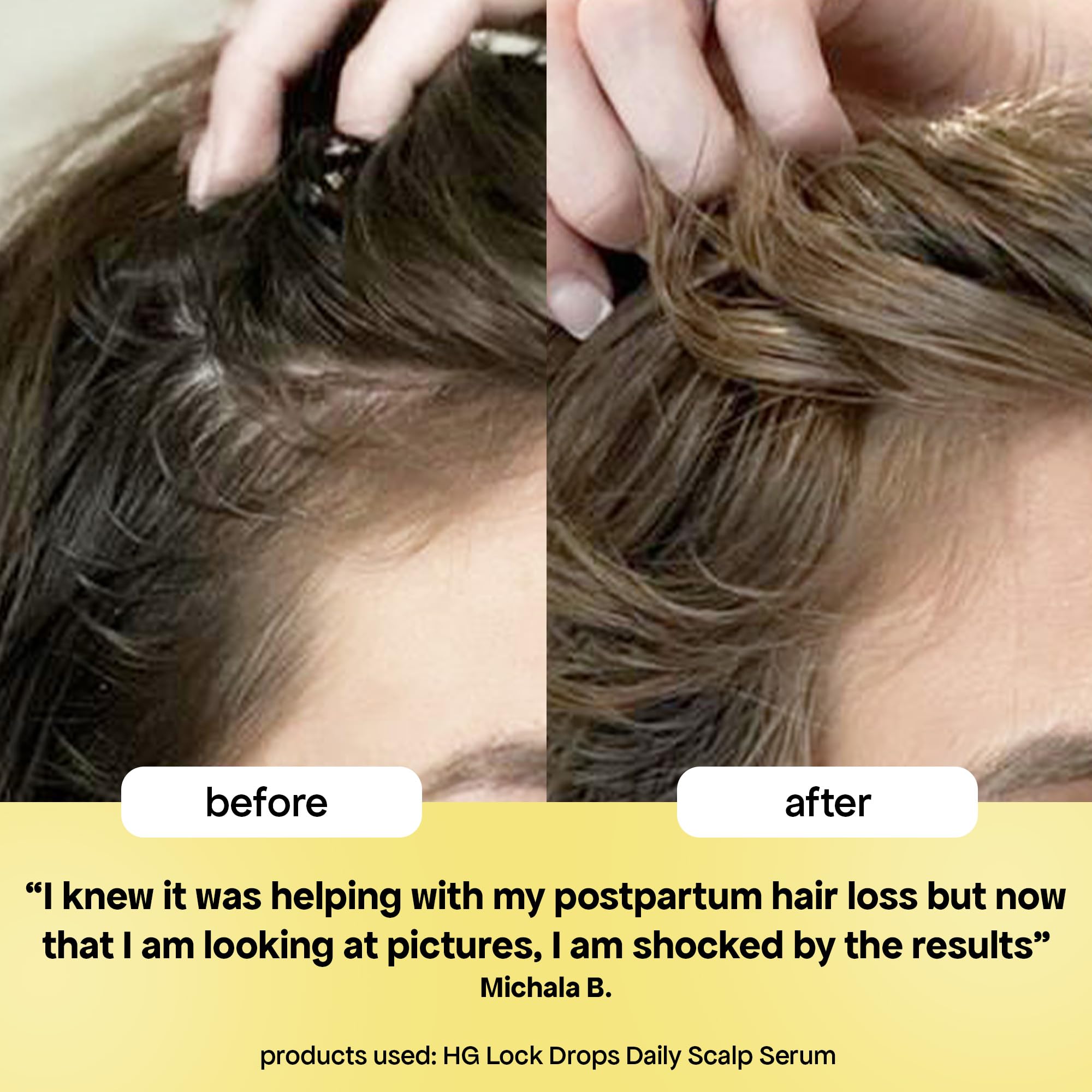 BondiBoost before and after styling showing fuller-looking hair