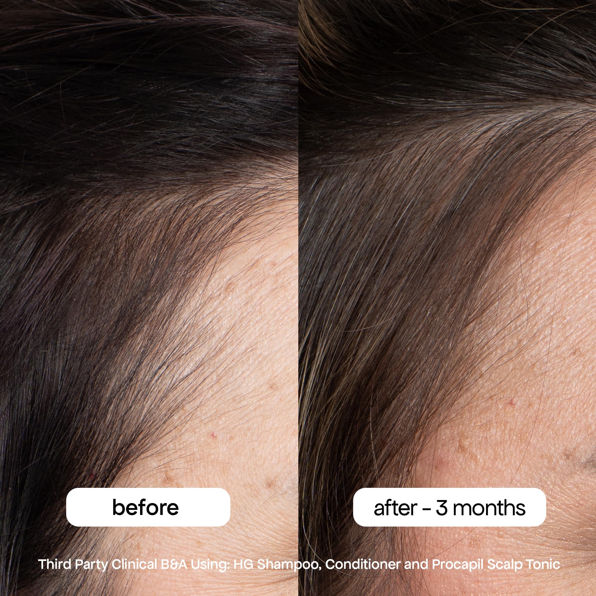 BondiBoost shampoo lather in hand, showcases effective cleansing and scalp refresh