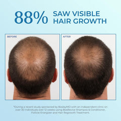 BosleyMD application demo on scalp illustrating targeted spray for focused coverage